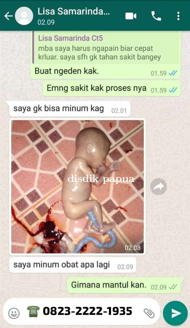 Apotik Jual Obat Aborsi Cytotec ( COD ) 082322221935 Pil Pelancar Haid Penggugur Jakarta 