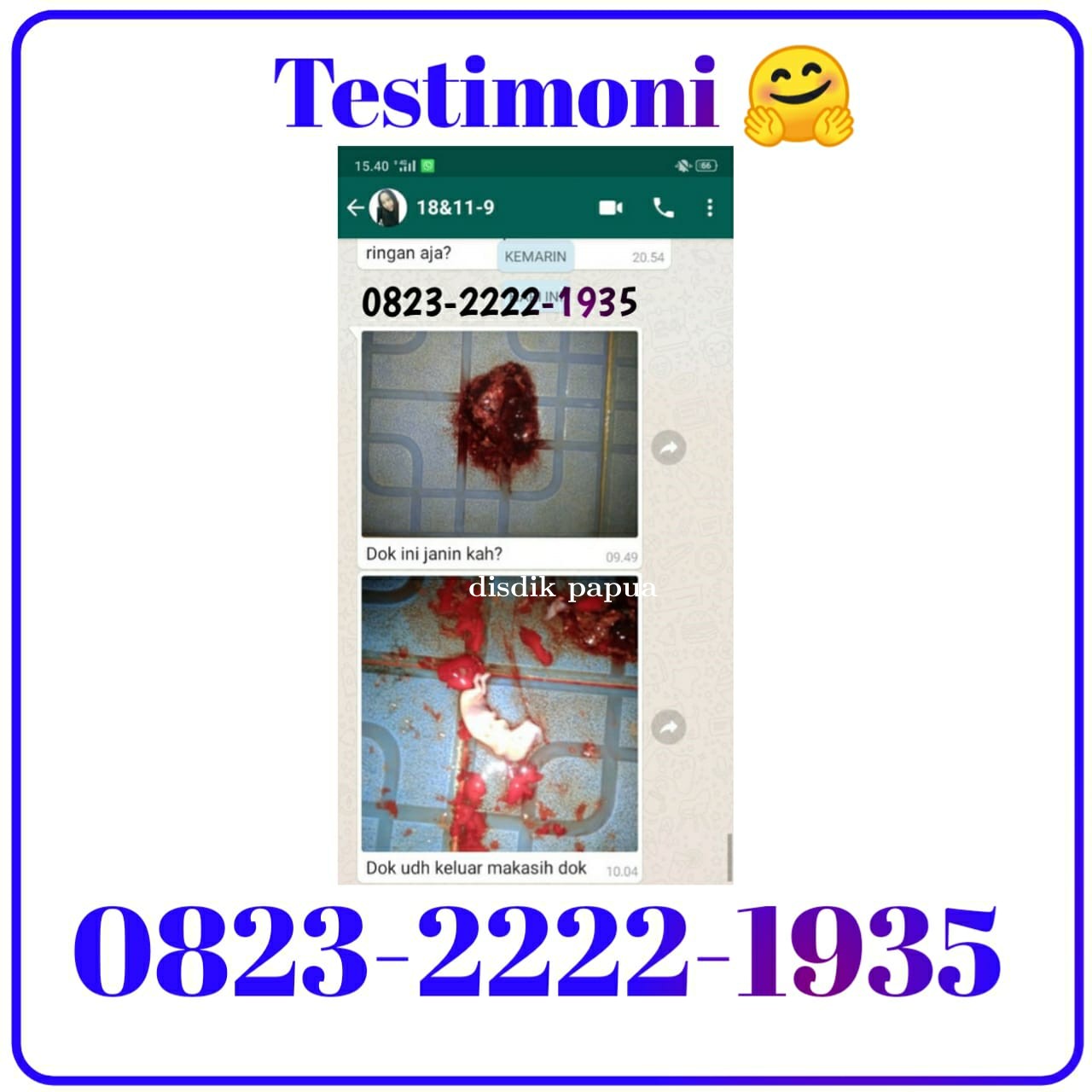 Bisakah Obat Cytotec Sebagai Obat Penggugur Kandungan ( Aborsi ) Jawabannya Jelas Bisa